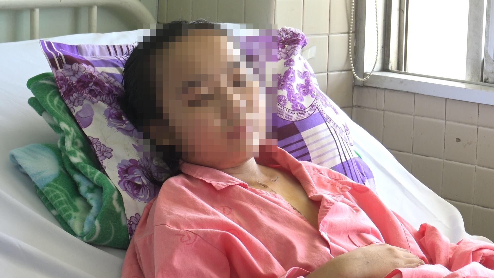Ai mắc bệnh này cũng chết, nhưng lần này cô gái 19 tuổi thoát án tử Cô gái 19 tuổi hồi phục nhanh chóng và đã có đường thở bình thường như bao người