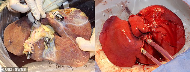 Công nghệ mới giúp giữ gan bên ngoài cơ thể đến 1 tuần trước khi cấy ghép Mẫu gan tách ra từ cơ thể người hiến (trái) được duy trì trong trạng thái tốt (phải) và thậm có thể tự phục hồi nhờ chiếc máy mới.