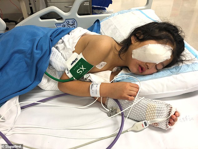 Bé gái rách toạc mí mắt, suýt mù vì té vào móc treo quần áo ở siêu thị May mắn cầu mắt của cô bé không bị tổn thương và phẫu thuật thẩm mỹ sẽ khắc phục một phần hậu quả.