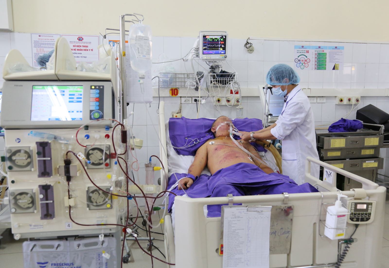 Bệnh liên cầu lợn tăng nhiều vào dịp cận tết nhưng dễ nhầm do rối loạn tiêu hóa Bệnh nhân bị liên cầu lợn đang được tích cực điều trị tại Bệnh viện Đa khoa tỉnh.
