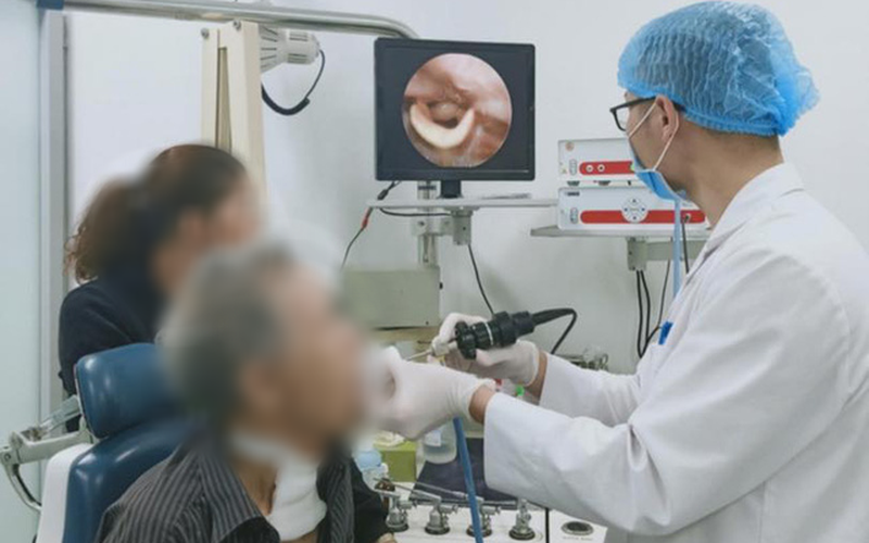 Cụ ông nguy kịch vì uống nhầm nước rửa chén Nội soi tai mũi họng thấy phù nề vùng sụn nắp thanh môn, phù nề toàn bộ vùng thanh môn, hạ họng ứ đọng rất nhiều dịch mủ đặc.