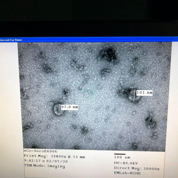 Ta không tin ta thì ai tin ta? Virus corona vừa được phân lập tại Viện Vệ sinh dịch tễ trung ương