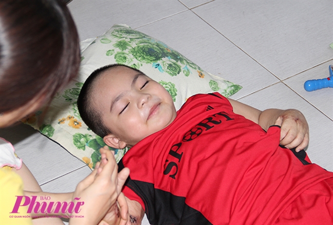 Hành trình nghị lực của cậu bé 5 tuổi bị phỏng nặng khi ngã vào chảo nước sôi Hanh trinh nghi luc cua cau be 5 tuoi bi phong nang khi nga vao chao nuoc soi