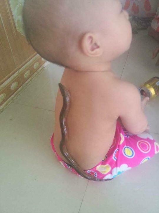 Tại sao trẻ hạ sốt khi cho con lươn bám vào lưng? Tai sao tre ha sot khi cho con luon bam vao lung?
