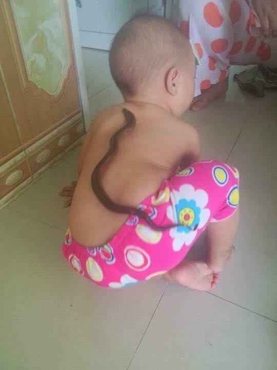 Tại sao trẻ hạ sốt khi cho con lươn bám vào lưng? Tai sao tre ha sot khi cho con luon bam vao lung?