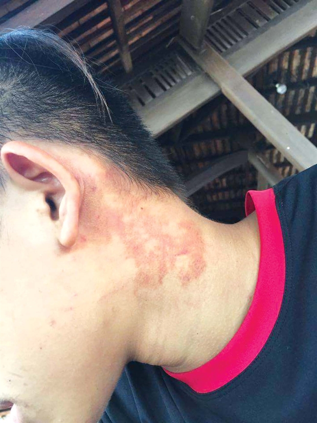 Bóc lột lao động trẻ em vẫn diễn ra từng ngày: Cuộc tháo chạy của lao động 'nhí' Boc lot lao dong tre em van dien ra tung ngay: Cuọc tháo chạy của lao dọng 'nhí'
