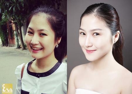 Điểm danh sao Việt công khai hình ảnh làm đẹp từ phòng thẩm mỹ Diem danh sao Viet cong khai hinh anh lam dep tu phong tham my