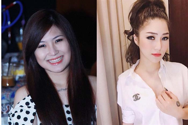 Điểm danh sao Việt công khai hình ảnh làm đẹp từ phòng thẩm mỹ Diem danh sao Viet cong khai hinh anh lam dep tu phong tham my