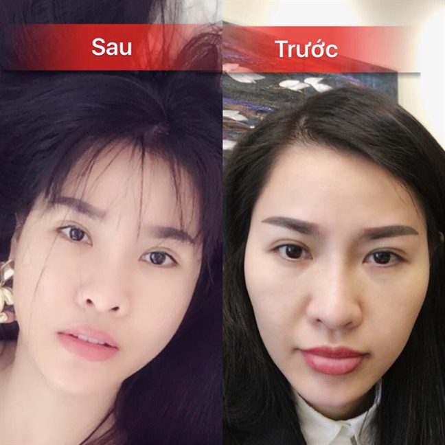 Điểm danh sao Việt công khai hình ảnh làm đẹp từ phòng thẩm mỹ Diem danh sao Viet cong khai hinh anh lam dep tu phong tham my