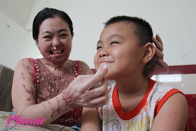 Bài 4: Người mẹ ma: Axít có thể phá hủy tôi nhưng tình mẹ con tôi là bất diệt Bai 4: Nguoi me ma: Axit co the pha huy toi nhung tinh me con toi la bat diet