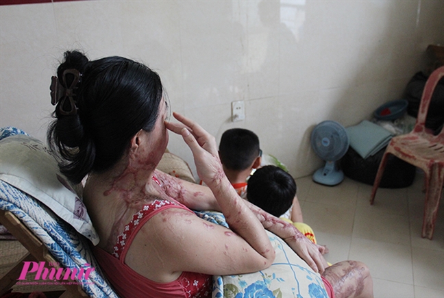 Bài 4: Người mẹ ma: Axít có thể phá hủy tôi nhưng tình mẹ con tôi là bất diệt Bai 4: Nguoi me ma: Axit co the pha huy toi nhung tinh me con toi la bat diet