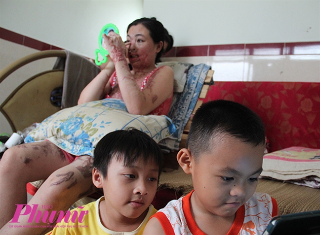 Bài 4: Người mẹ ma: Axít có thể phá hủy tôi nhưng tình mẹ con tôi là bất diệt Bai 4: Nguoi me ma: Axit co the pha huy toi nhung tinh me con toi la bat diet