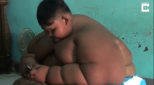 Bé trai 10 tuổi nặng 190kg vì nghiện nước ngọt và mì ăn liền Be trai 10 tuoi nang 190kg vi nghien nuoc ngot va mi an lien