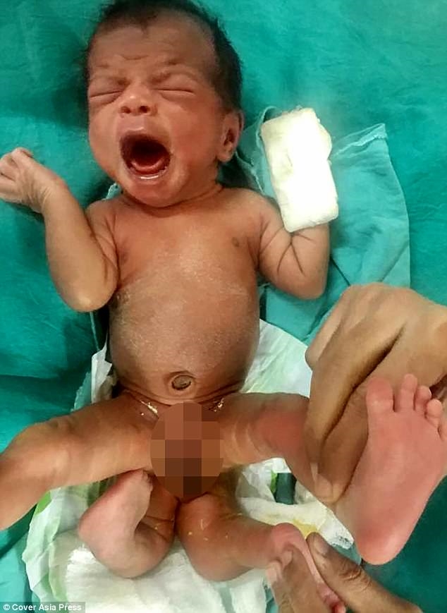 Không siêu âm khi mang thai, sản phụ hoảng vì con có 4 chân Khong sieu am khi mang thai, san phu hoang vi con co 4 chan