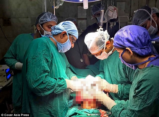 Không siêu âm khi mang thai, sản phụ hoảng vì con có 4 chân Khong sieu am khi mang thai, san phu hoang vi con co 4 chan