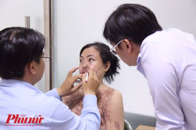 ‘Người mẹ ma’ bắt đầu cuộc chiến tìm lại gương mặt mình ‘Nguoi me ma’ bat dau cuoc chien tim lai guong mat minh