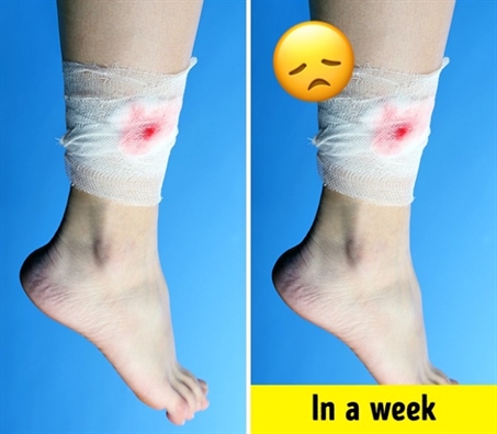 Giảm cân nhanh, da khô là dấu hiệu bạn ăn quá nhiều đường Giam can nhanh, da kho la dau hieu ban an qua nhieu duong