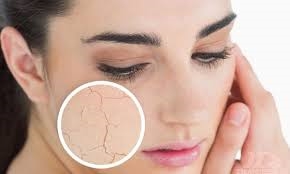 Giảm cân nhanh, da khô là dấu hiệu bạn ăn quá nhiều đường Giam can nhanh, da kho la dau hieu ban an qua nhieu duong
