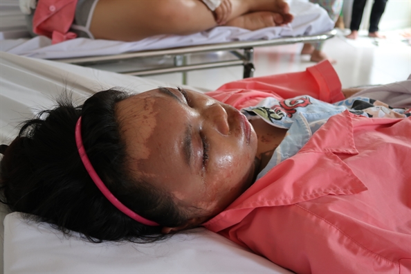 Bốn người bị tạt axit ở Đồng Nai: Một phút nóng nảy, hai gia đình tan nát Bon nguoi bi tat axit o Dong Nai: Mot phut nong nay, hai gia dinh tan nat