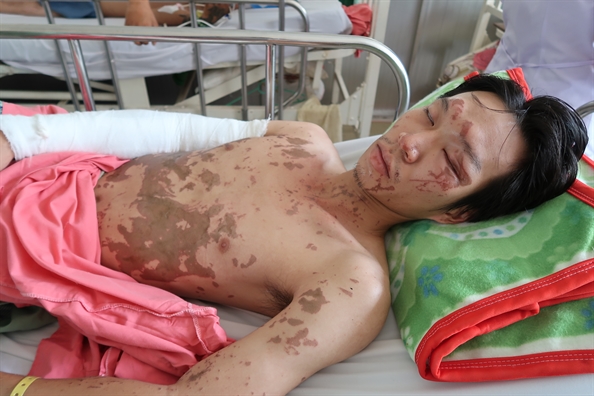 Bốn người bị tạt axit ở Đồng Nai: Một phút nóng nảy, hai gia đình tan nát Bon nguoi bi tat axit o Dong Nai: Mot phut nong nay, hai gia dinh tan nat