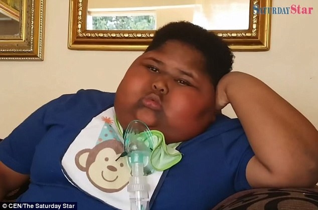 Bé trai béo phì ăn cả giấy vệ sinh khi đói Be trai beo phi an ca giay ve sinh khi doi