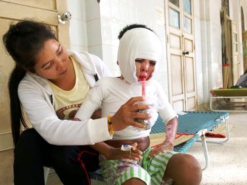 Những tai nạn khó ai ngờ sẽ xảy ra với trẻ em Nhung tai nan kho ai ngo se xay ra voi tre em