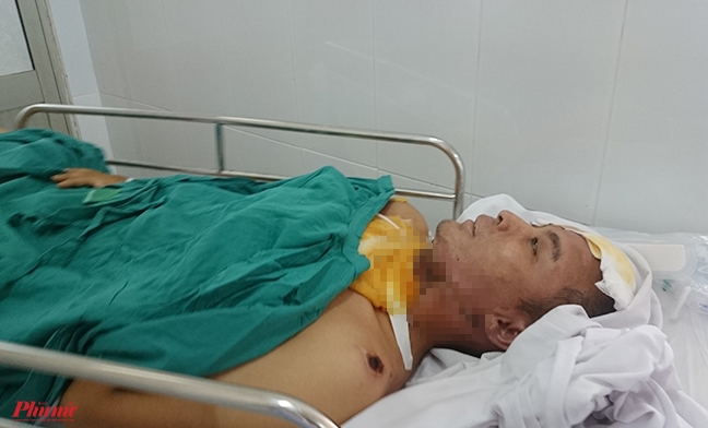 Còn vài tháng ra trường, nam sinh viên ham học bị điện giật cháy sâu vào xương sọ Con vai thang ra truong, nam sinh vien ham hoc bi dien giat chay sau vao xuong so