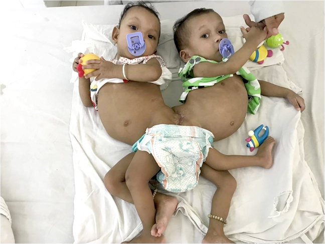 Người mẹ 19 tuổi đau lòng khi thiên hạ nói 2 con mình chỉ có 1 cái mông Nguoi me 19 tuoi dau long khi thien ha noi 2 con minh chi co 1 cai mong
