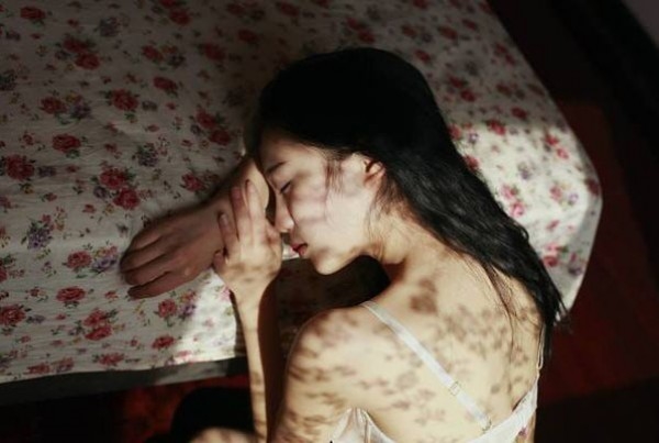 Sợ chồng bỏ, tôi phải phẫu thuật để tìm lại cái 'ngàn vàng' So chong bo, toi phai phau thuat de tim lai cai 'ngan vang'