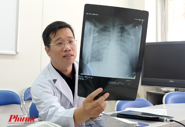 Tiết lộ tấm phim phổi mờ trắng khó hiểu của đạo diễn V.T.V. Tiet lo tam phim phoi mo trang kho hieu cua dao dien V.T.V.