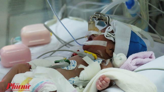 Tai họa ập đến khi bé bú sữa no, mẹ liền bế đi tắm Tai hoa ap den khi be bu sua no, me lien be di tam