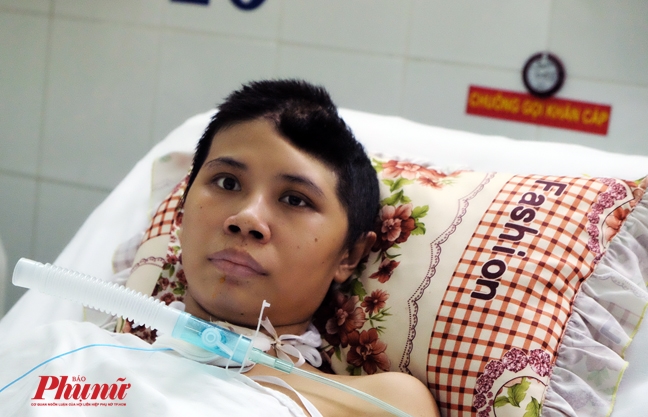 Vỡ mạch máu não khi mang thai, người mẹ lúc nhớ lúc quên Vo mach mau nao khi mang thai, nguoi me luc nho luc quen