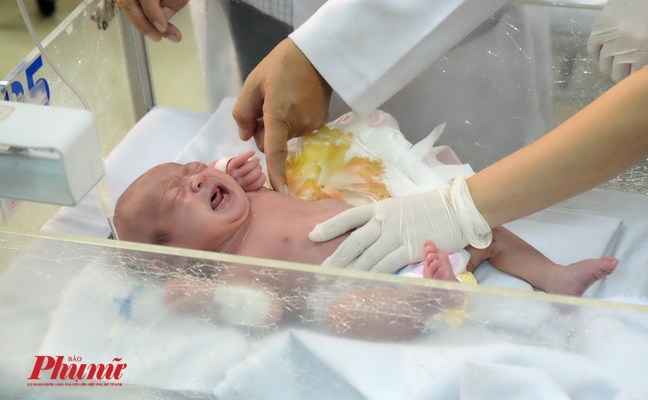 Bác sĩ chỉ cách phát hiện u từ lúc em bé còn trong bụng mẹ Bac si chi cach phat hien u tu luc em be con trong bung me