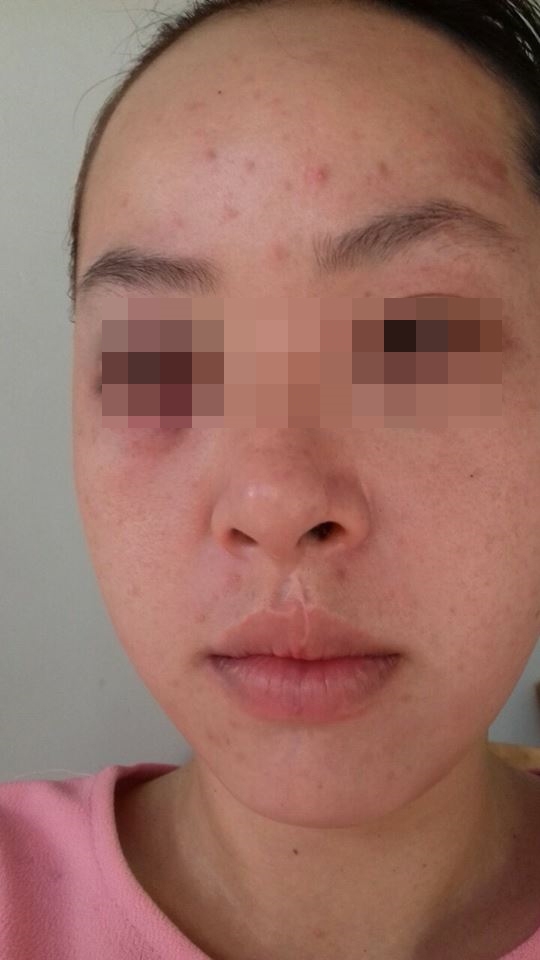 Lấy vợ để có người chăm sóc mẹ tâm thần, nay mẹ chết, chồng đánh đuổi vợ ra khỏi nhà Lay vo de co nguoi cham soc me tam than, nay me chet, chong danh duoi vo ra khoi nha