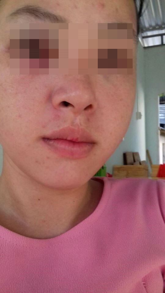 Lấy vợ để có người chăm sóc mẹ tâm thần, nay mẹ chết, chồng đánh đuổi vợ ra khỏi nhà Lay vo de co nguoi cham soc me tam than, nay me chet, chong danh duoi vo ra khoi nha