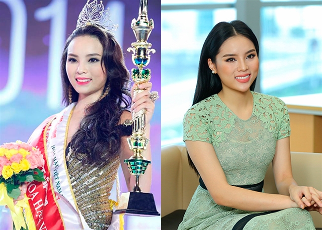 Những 'nàng hậu' gây ồn ào với nghi án phẫu thuật thẩm mỹ Nhung 'nang hau' gay on ao voi nghi an phau thuat tham my