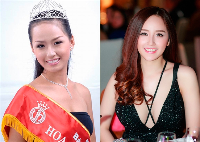 Những 'nàng hậu' gây ồn ào với nghi án phẫu thuật thẩm mỹ Nhung 'nang hau' gay on ao voi nghi an phau thuat tham my