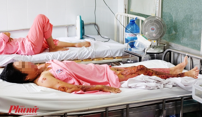 Sau khi tạt axit vì ghen, cụ ông viết 'tâm thư' dọa giết người tình Sau khi tat axit vi ghen, cu ong viet 'tam thu' doa giet nguoi tinh