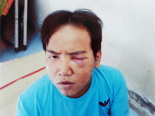Lời khai kinh hoàng của nam bảo vệ dân phố cắt cổ cháu bé Loi khai kinh hoàng của nam bảo vẹ dan phó cat co chau be