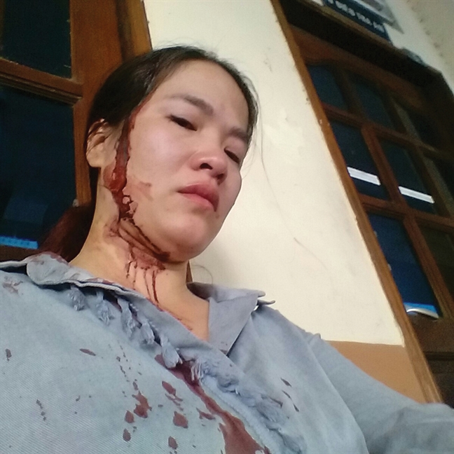 Đến thăm con ở chỗ chồng cũ, mẹ bị đánh đổ máu Den tham con o cho chong cu, me bi danh do mau