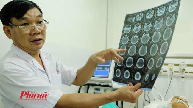 Vụ xe ben cuốn hàng loạt xe máy ở Gò Vấp: Đã có người chết, người sống đang nguy kịch Vu xe ben cuon hang loat xe may o Go Vap: Da co nguoi chet, nguoi song dang nguy kich
