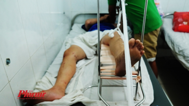 Vụ xe ben cuốn hàng loạt xe máy ở Gò Vấp: Đã có người chết, người sống đang nguy kịch Vu xe ben cuon hang loat xe may o Go Vap: Da co nguoi chet, nguoi song dang nguy kich