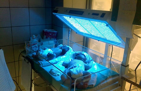 Bác sĩ chỉ cách phát hiện sớm vàng da cho trẻ sơ sinh dưới ánh nắng mặt trời Bac si chi cach phat hien som vang da cho tre so sinh duoi anh nang mat troi