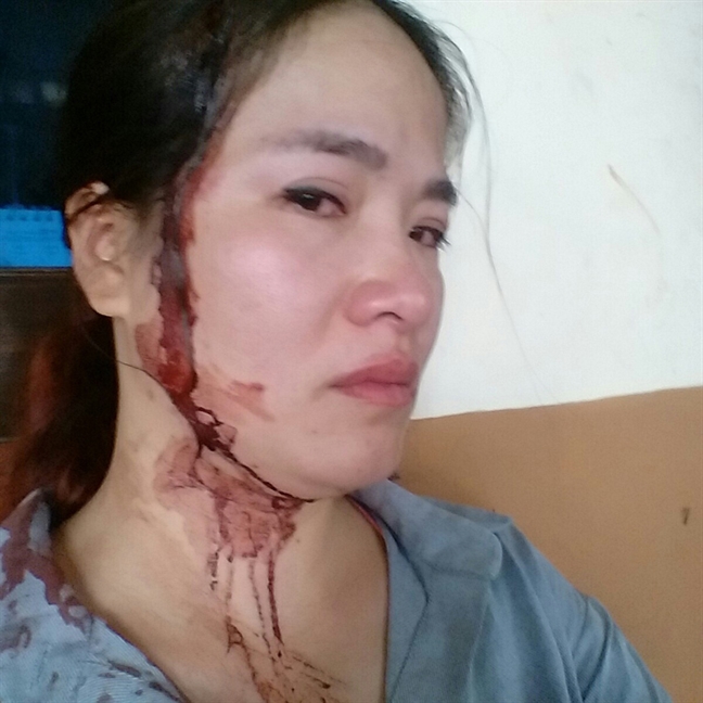 Vụ 'Đến thăm con ở chỗ chồng cũ, mẹ bị đánh đổ máu': Tòa tuyên trao quyền nuôi con cho người mẹ Vu 'Den tham con o cho chong cu, me bi danh do mau': Toa tuyen trao quyen nuoi con cho nguoi me