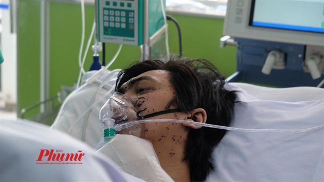 Phó Thủ tướng Trương Hòa Bình động viên các nạn nhân vụ cháy chung cư Carina Pho Thu tuong Truong Hoa Binh dong vien cac nan nhan vu chay chung cu Carina