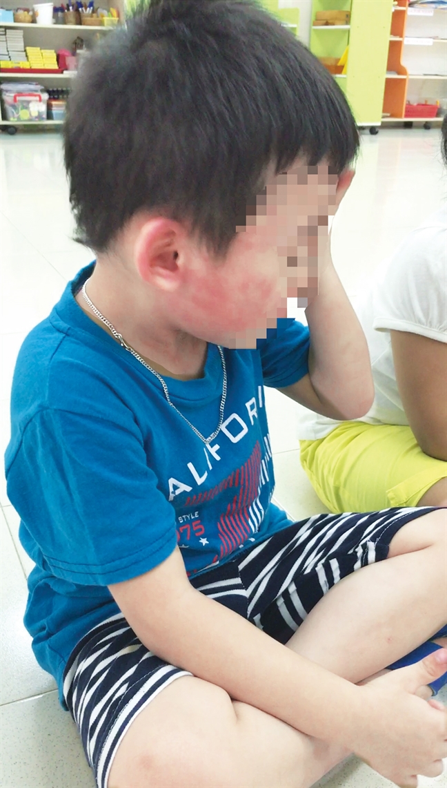 Đôi mắt nào cho trẻ Doi mat nao cho tre