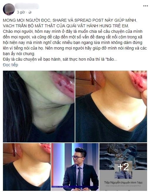 Vụ MC Minh Tiệp: Người lớn đang 'đay nghiến' kết quả của chính mình Vu MC Minh Tiep: Nguoi lon dang 'day nghien' ket qua cua chinh minh
