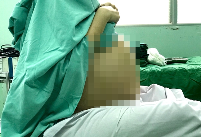 Bụng to bất thường, cô gái 20 tuổi đi khám phát hiện u buồng trứng 7kg Bung to bat thuong, co gai 20 tuoi di kham phat hien u buong trung 7kg