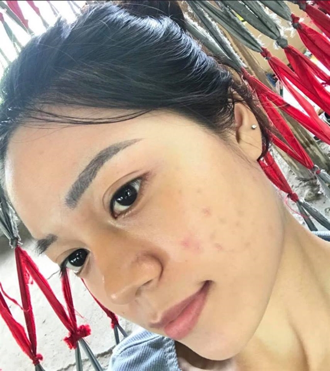 3 phương pháp thải độc cho da hiệu quả do môi trường bẩn 3 phuong phap thai doc cho da hieu qua do moi truong ban