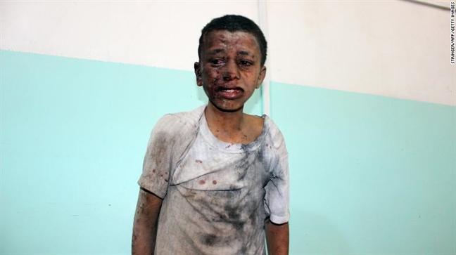 Thảm kịch không kích nhầm tại Yemen: Những tiếng cười cuối cùng trước khi bom nổ Tham kich khong kich nham tai Yemen: Nhung tieng cuoi cuoi cung truoc khi bom no